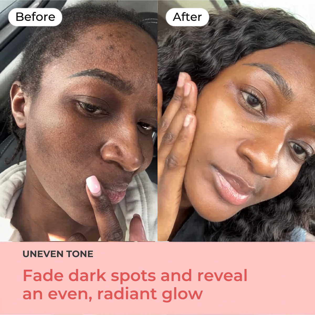 The Lumina Glow Mask — 7-Color LED Light Therapy