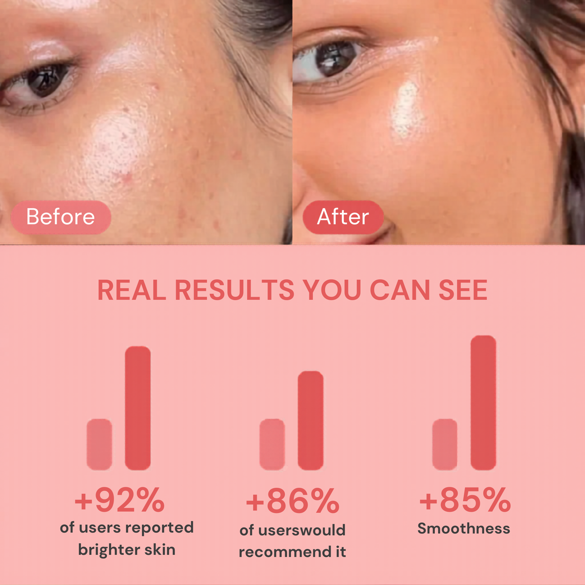 The Lumina Glow Mask — 7-Color LED Light Therapy